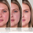 Before and After Image, HydroPure™ Colour Correcting Serum with Hyaluronic Acid & CoQ10